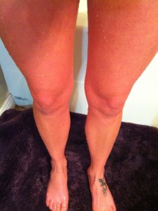 Red legs after icy bath,